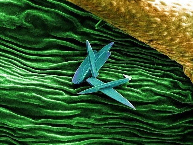 Неизвестные кристаллы, найденные на поверхности почки