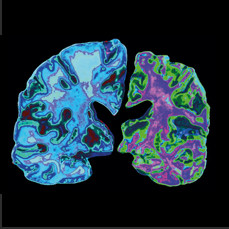 Чашечка для бонга